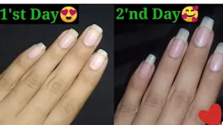 How to Grow Nails in 2 Days || How to Grow Nails Fast |4.M|#shortsvideo#instagram#viralvideo