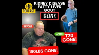 How Semi-Retired Bob Cured Gout, Chronic Kidney Disease, Fatty Liver Disease and Diabetes