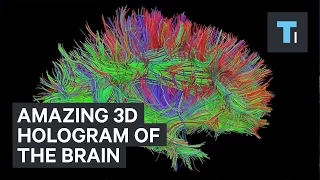 3D hologram of the brain’s connections