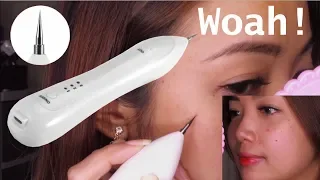 Warts and Mole Remover Pen... EFFECTIVE or NOT!?