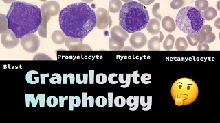 The different morphologies of Granulocytes (neutrophils, eosinophils and basophils)