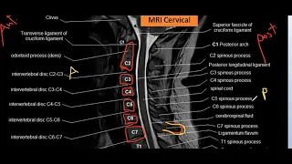 Introduction-  How to Identify MRI Cervical spine