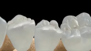 Регенерация зубов / Tooth Regeneration