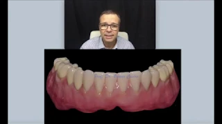 Dentadura inferior dançando???