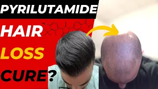 Is Pyrilutamide The Hair Loss Cure We've Been Waiting For?