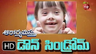 Aarogyamastu - World Down Syndrom Day-21st March 2016 - ఆరోగ్యమస్తు - Full Episode