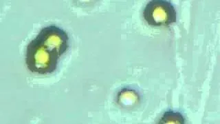 Chlorella vulgaris under microscope