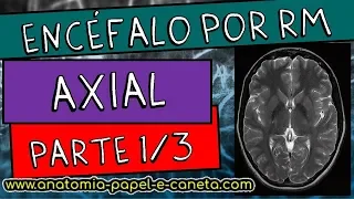 Anatomia radiológica - Encéfalo por RM (Parte 1/3) - CORTE AXIAL