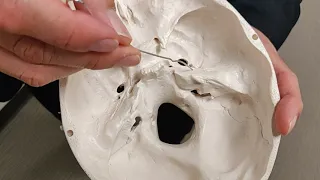 Skull anatomy for neuroophthalmolgy