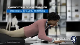 3D Trip and Fall Animation Shows Mechanism of Injuries At Department Store