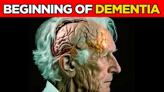 6 Early SIGNS of DEMENTIA You Should NEVER IGNORE! Silent Symptoms of ALZHEIMER'S