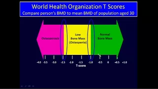 Premenopausal Osteoporosis: Pathogenesis and Management