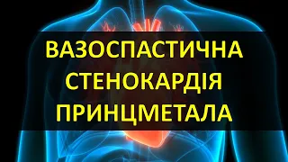 ВАЗОСПАСТИЧНА СТЕНОКАРДІЯ , СТЕНОКАРДІЯ ПРИНЦМЕТАЛА, ВАРІАНТНА СТЕНОКАРДІЯ