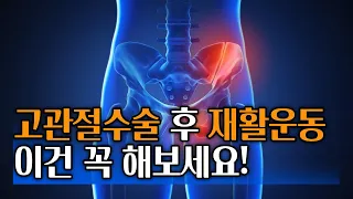 고관절 수술 후 재활운동