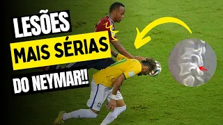 Neymar: Lesões mais sérias do Neymar