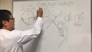 Optic Tract Syndrome