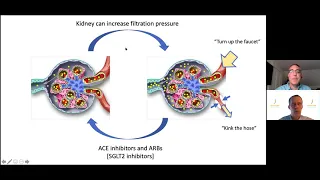 Membranous Nephropathy: Sharing Breakthroughs and Recent Discoveries