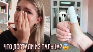 VLOG Сделали операцию на пальце...