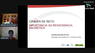 PAPEL DA RESSONÂNCIA NA DEFINIÇÃO DO TRATAMENTO DO CÂNCER DE RETO. – Dra Claudia Carrada