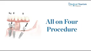 Get an all-on-4 dental implants procedure in Ciudad Juarez - Medical Tourism