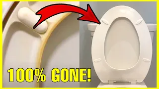 How to REMOVE YELLOW STAINS from Toilet Seat!! (Get Toilet White Again) | Andrea Jean