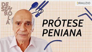 Como funciona a prótese peniana?