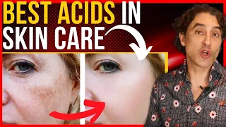 LOOK 10 YEARS 💎 YOUNGER 💎 with THESE ACIDS // Skin Care