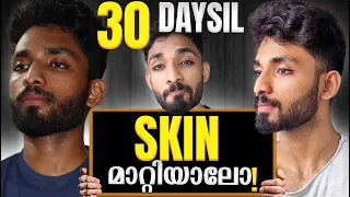 Clear ALL YOUR SKIN PROBLEMS in 30 DAYS. SCIENTIFIC GUIDE to remove PIMPLES, ACNE, BLACKHEAD at HOME