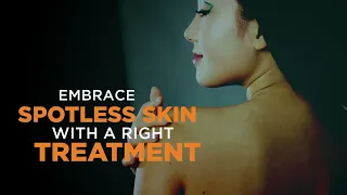 Best Vitiligo Treatment | How to Remove White Spots From Face & Skin- The Esthetic Clinics, Mumbai