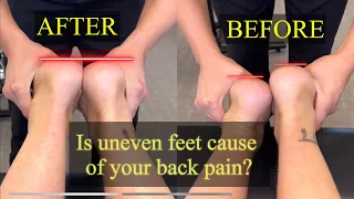 Fix short leg, reduce back pain