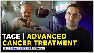 Advance Cancer Treatment | CHEMOTHERAPY | TACE | Liver cancer treatment | Dr. Gaurav Gangwani