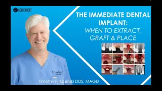 Webinar 9.19.23 - Dr. Tim Kosinski - Extractions, Grafting & Immediate Dental Implants
