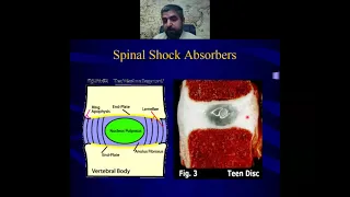 the spine degenerative disc disease part I
