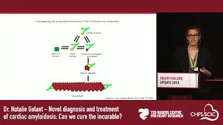 Cardiac amyloidosis: Can we cure the incurable?