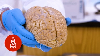 Brain Freeze: Welcome to the Country's Largest Brain Collection