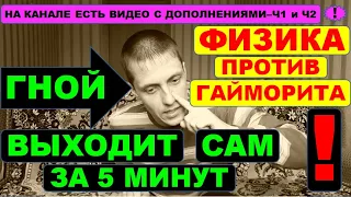 ГАЙМОРИТ, СИНУСИТ. ГНОЙ вылетит сам⚠️силами ФИЗИКИ ☝️ Мгновенное лечение МЕТОДОМ САМОПРОДУВКИ✔