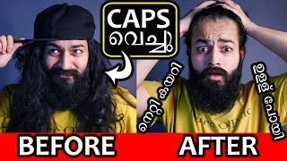 Caps And Beanies വെച്ചാൽ  കഷണ്ടി  ആകുമോ ? | Frontal Hairloss | Hair Thinning | LHG