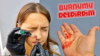 BURNUMU DELDİRDİM ÇOK KANADI VLOG