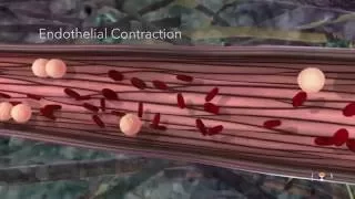 Acute Inflammation- Educational 3D Animation