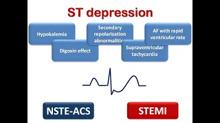 ECG course: ST segment depression (ischemia & others), Dr. Sherif Altoukhy