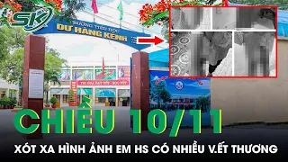 Chiều 10/11: Xót Xa Em Học Sinh Sống Với Mẹ Và “Bố Dượng Hờ” Có V.ết Th.ương Khó Hiểu | SKĐS