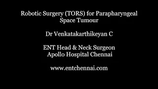 Robotic Surgery (TORS) for Parapharyngeal Space Tumour