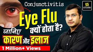 Eye Flu : Conjunctivitis यानी Eye Flu क्यों होता है? Cause, Prevention & Treatment By Siddharth Sir