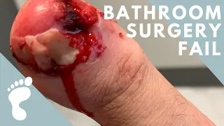 BATHROOM SURGERY DISASTER