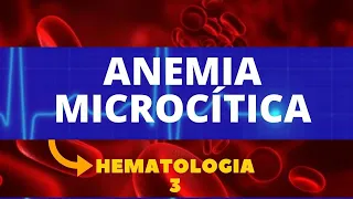 ANEMIA MICROCÍTICA - HEMATOLOGIA - AULA 3
