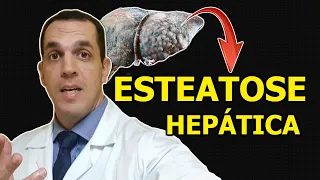 MELHOR REMÉDIO PARA GORDURA NO FÍGADO [ASSISTA!] | Dr. Gabriel Azzini