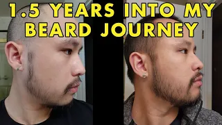 Minoxidil Beard | 18 Months into my Asian Beard Growth Journey