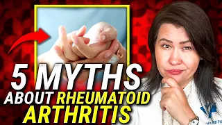 Unveiling the Truth: 5 Common Myths about Rheumatoid Arthritis