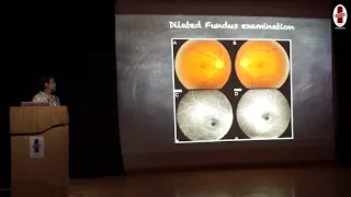 Ocular Complication of Systemic Medications