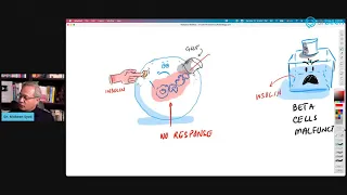 Diabetes Mellitus - Mechanism and Causes of Insulin Resistance